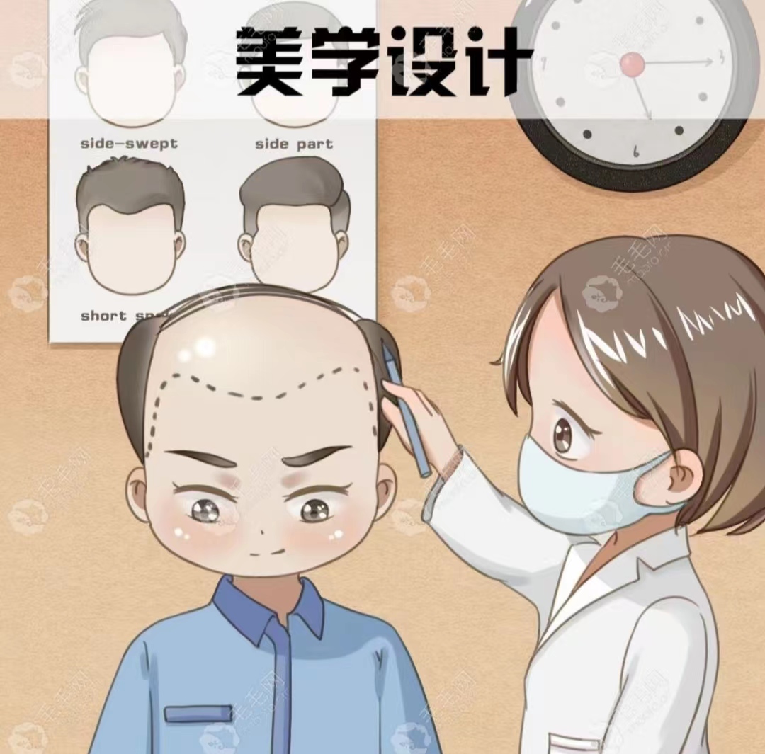 南京植发