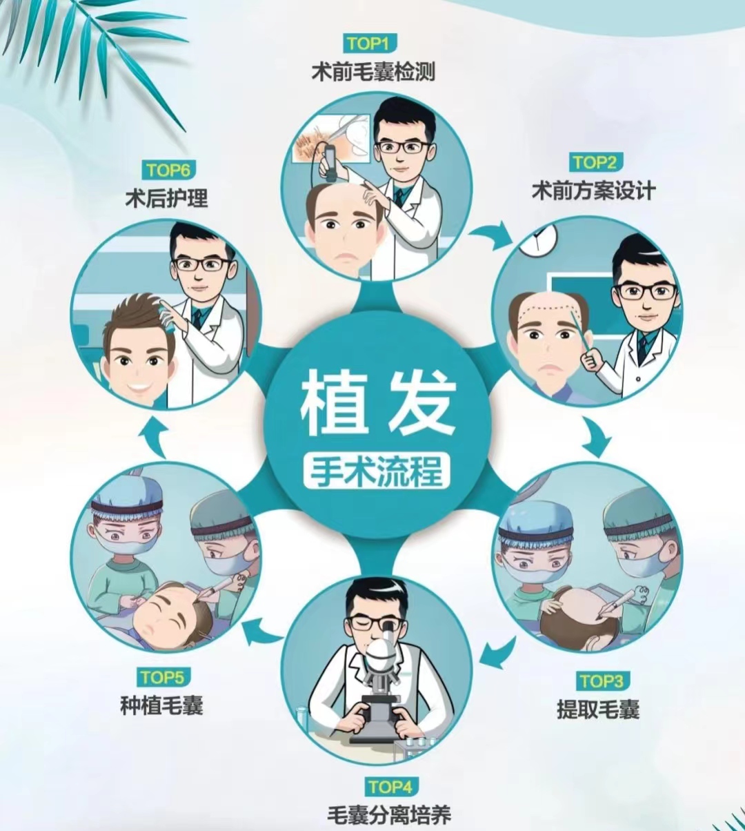 南京植发套餐价格